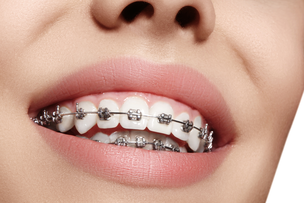 orthodontics