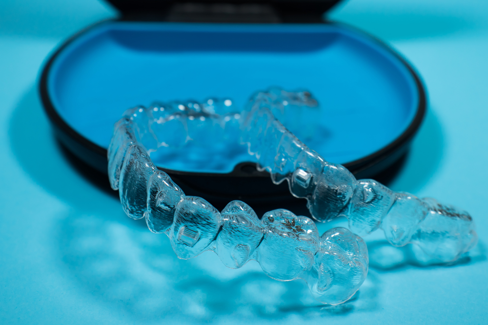 clear aligners