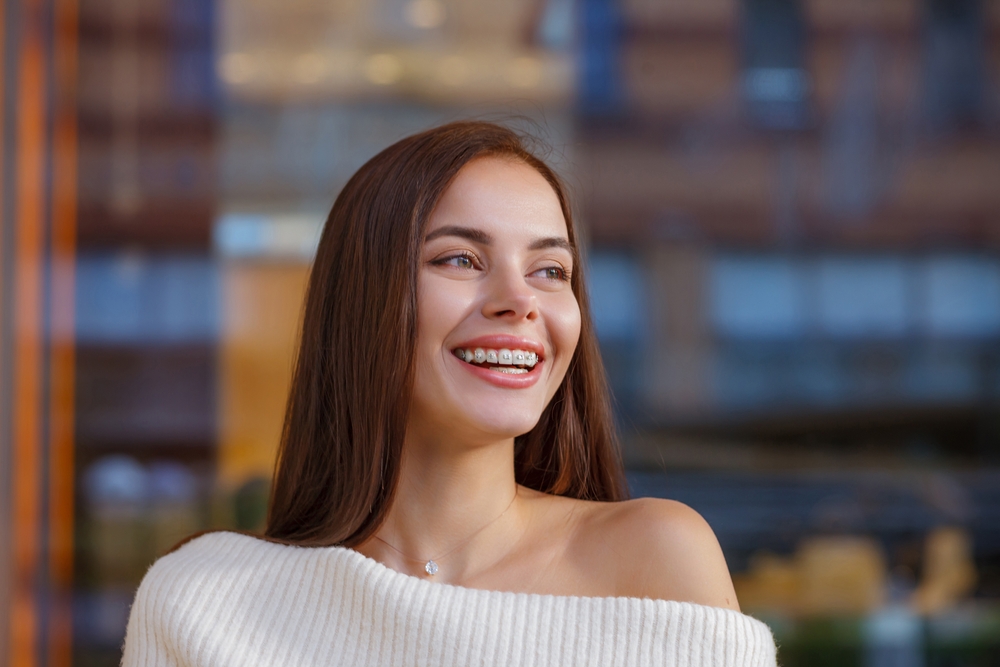 traditional braces