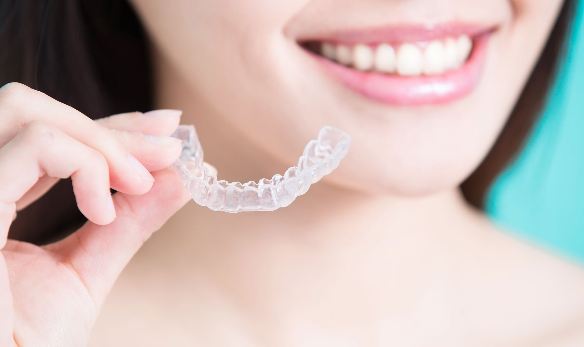 Invisalign Procedure in Vista